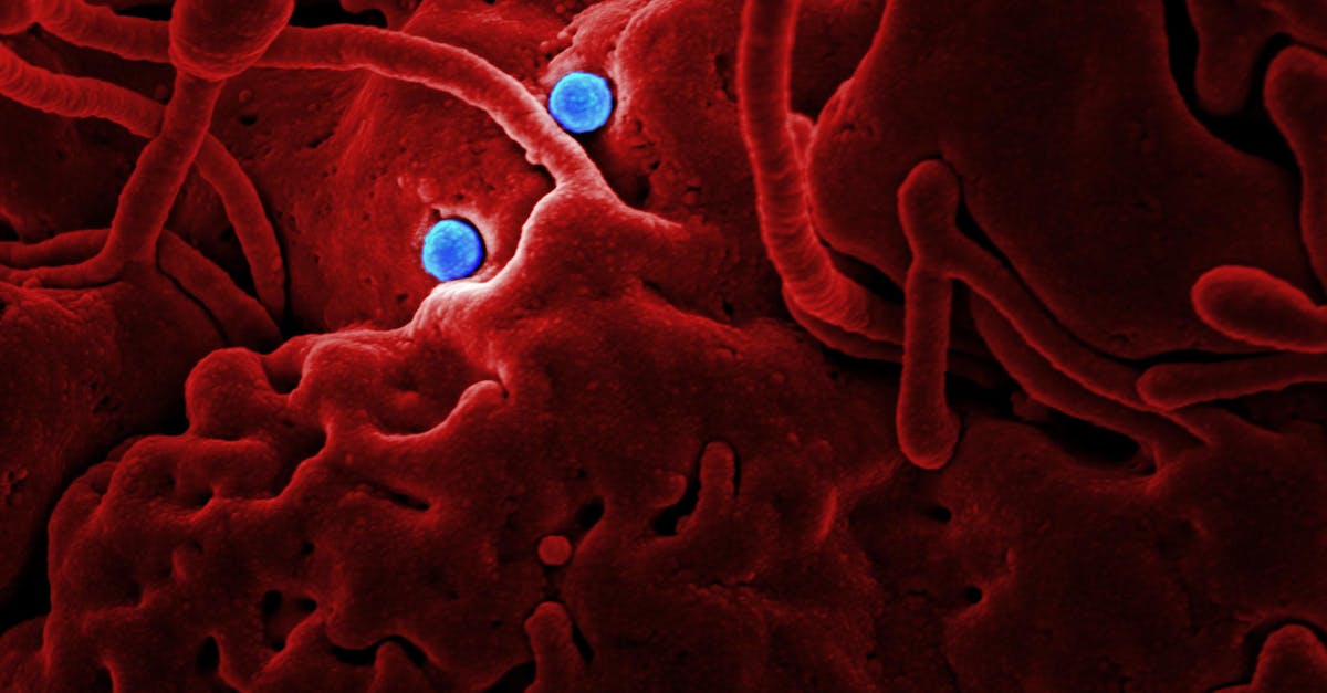 découvrez tout ce qu'il faut savoir sur l'influenza : symptômes, modes de transmission, prévention et traitements. informez-vous pour protéger votre santé et celle de vos proches.