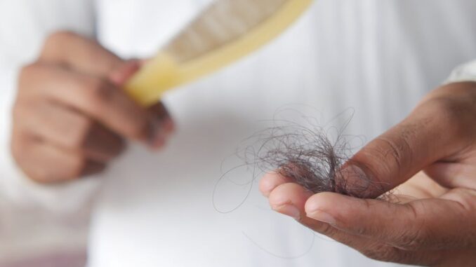 scalp itching découvrez les causes et les solutions efficaces pour soulager les démangeaisons du cuir chevelu. apprenez à identifier les irritations et à adopter des soins adaptés pour retrouver un cuir chevelu sain et apaisé.